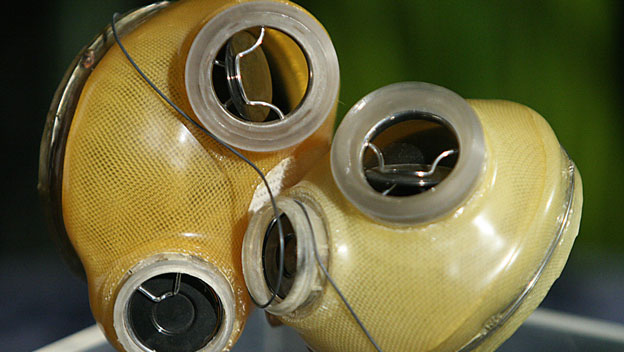 First Artificial Heart Recipient